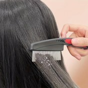 Resim Kalın Saçlar için İnce Dişli Tarak - Ergonomik ABS Saplı Paslanmaz Çelik, Yetişkinler ve Evcil Hayvanlar için Nazik Açma ve Etkili Kepek Giderme, Kafa Derisi Bakımı Saç Fırçası, Evcil Hayvan Tüyü Dökülmesi Çözümü | Şık Araç Tasarımı, Saç Tarağı 
