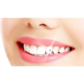 Resim LTG Nova Diş Kristali ve Diş Pırlantası Komple Set - Muhteşem Gülüş Seti 