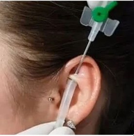 Resim Piercing Delim İğnesi 1.3 Mm Yeşil Steril Tek Kullanımlık Anjiokat 3 Adet Kulak, Dudak, Kaş Delimi 