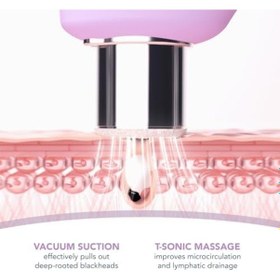 Resim Foreo Derma - 57858324446565399283959 