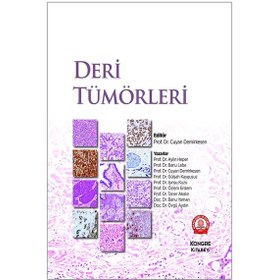 Resim Deri Tümörleri 
