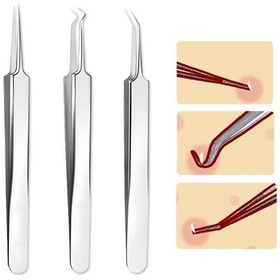 Resim Çelik Hassas Siyah Nokta Cımbız Hücre Klip Akne İğnesi Komedon Sökücü Akne Cımbız Cilt Bakımı Komedon Akne Extracto 