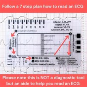 Resim Elektrokardiyograflar için kullanılan plastik cetvel ölçüm aracı, 7 basamaklı bir ölçekle ECG'leri yorumlamak için kullanılır. 