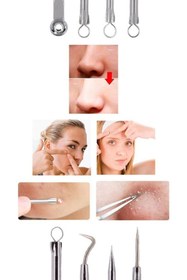 Resim Genel Markalar 4 Lü Kutulu Paslanmaz Komedon Akne - Siyah Nokta Temizleyici Set 