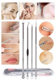 Resim zizix Paslanmaz Çelik Siyah Nokta Temizleme Çubukları Siyah Nokta Akne Aleti 4 Lü 