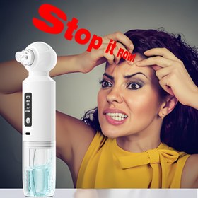 Resim Yeni Sıcak Kompres Siyah Nokta Temizleyici Gözenek Arındırıcı Güzellik Cihazı, Altı Emme Başlığı, Sıcak Kompres Fonksiyonunu Etkinleştirmek İçin Güç Düğmesine Üç Saniye Basılı Tutun, Otomatik Olarak 46 Derecede Sıcaklık Korur 