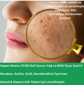 Resim Sera Natura Acne Care Akne Karşıtı Cilt Bakım Yağı 20 ML 