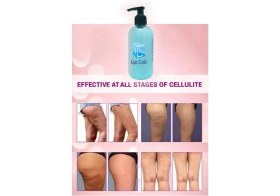 Resim Buğz Lipo Cold Seliülitlerinize&fazlalıklarınıza Karşı Soğuk Bakım Kremi 250 ml x 1 Adet 