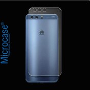 Resim Microcase Huawei P10 Plus Full Arka Kaplama Tpu Soft Koruma Filmi 