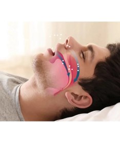 Resim Epilons Rahat Uyku Için Anti Snore Sleep Horlama Engelleyici Aparat Uyku Stoperi 