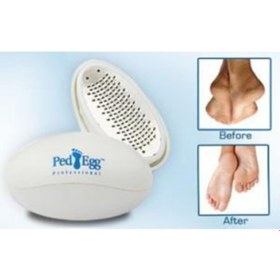 Resim Medilix Ped Egg Topuk Törpüsü - Ergonomik & Pratik 