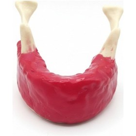 Resim Mandibula İmplant Eğitim Modeli - Dişsiz Alt Çene Simülasyonu 