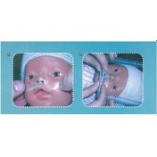 Resim Eparox Hidrokolloid Burun Bandı No:2 