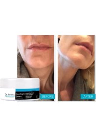 Resim Dr. Botoks Yaşlanma ve Kırışıklar Karşıtı Zamana Meydan Okutacak Krem 50 ml 