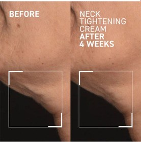 Resim Dr.brandt Needles No More Neck Tightening Cream Sıkılaştırıcı Boyun Kremi 