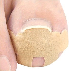 Resim 20 adet Hipoalerjenik Batık Tırnak Düzeltme Pedleri - Ayak Bakımı için Profesyonel Pedikür Aracı, Tırnak Dosyası ve Tırnak Kavrama Aracı Dahil, Kıvrılmış ve Kalın Tırnaklar için İdeal, Tırnak Bakımı Çözümü|Profesyonel Pedikür Aracı|Hipoalerjenik Pedler 