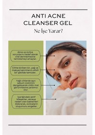 Resim Peonies acne Cleanser Gel Yağlı Akneli Ve Karma Ciltler Için Salisilik Asitli Yıkama Jeli 