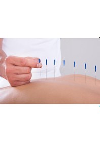 Resim Akupunktur İğnesi Kuru İğne.Acupuncture Needle 0.20*13Mm 