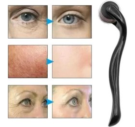 Resim Savarga Dermaroller Titanyum 540 Iğneli 1 mm Saç Kaş Sakal Serum Kullanıma Uygun 