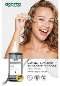 Resim Agarta Siyah Nokta ve Akne Karşıtı Serum 50 ML 