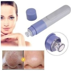 Resim Pore Cleaner Vakumlu Siyah Nokta Temizleyici Yüz Temizleme Aleti 
