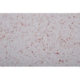 Resim Orjinal Canlı Sıva (166052274) 