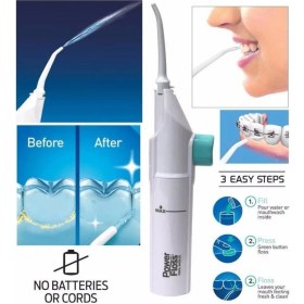 Resim Kuzgun Ticaret Portatif Tasarım Power Floss Mekanik Diş ve Ağız Temizleme Aleti ( Lisinya ) 