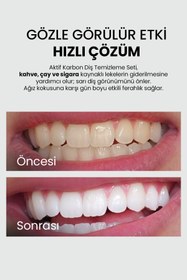 Resim Luis Bien Diş Beyazlatma Seti | Organik Aktif Karbonlu | Çay, Kahve ve Sigara Lekesi Karşıtı | Plak Önleyici 