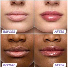 Resim Wonderskin Lip Rehab Nemlendirici Ve Onarıcı Renkli Dudak Serumu Yağı Honey 3.57ml 