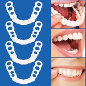 Resim 2 adet Ayarlanabilir Silikon Ortodontik Tutucular - Temizlenmesi Kolay, Doğal Uyum, Güvenli Gülümseme - Erkekler ve Kadınlar için Mükemmel Noel Hediyesi, Plastik Malzeme, Ortodontik |Ayarlanabilir Tutucular|Plastik Tutucular 