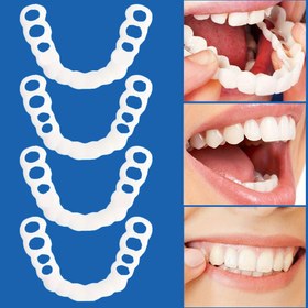 Resim 2 adet Ayarlanabilir Silikon Ortodontik Tutucular - Temizlenmesi Kolay, Doğal Uyum, Güvenli Gülümseme - Erkekler ve Kadınlar için Mükemmel Noel Hediyesi, Plastik Malzeme, Ortodontik |Ayarlanabilir Tutucular|Plastik Tutucular 