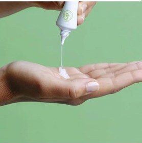 Resim Akne Karşıtı Bakım Kremi, 40ml Etkili Formül 