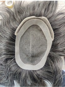 Resim EPS12 Erkek Protez Saç Ankara Modeli 