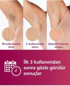 Resim Philips 450.000 Atımlık Premium Epilasyon Full Set | Cilt Tonu Sensörlü, Tüy Alma Ve Traş Makinesi 