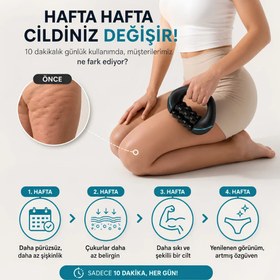 Resim VELNORA™ Elektrikli Döner Masaj Aleti - Selülit Karşıtı, Vücut Sıkılaştırıcı ve Şekillendirici 