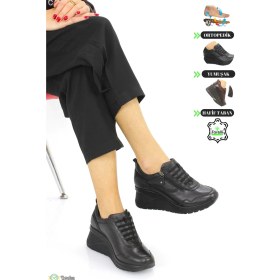 Resim Forelli Kadın Deri Ortopedik Dolgu Topuk Günlük Ayakkabı F24/CM27913 