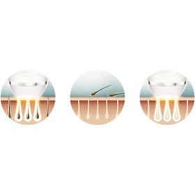 Resim Philips Yeni Seri 2 Başlık (VÜCUT, YÜZ) Ipl Lazer Epilasyon Cihazı, Kaydırarak Uygulama Modu,lambader Hediye 