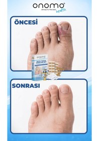 Resim Health Batık Tırnak Düzeltme Seti 61 Adet 