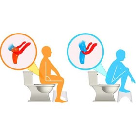 Resim OMAK Medikal Klozet Taburesi 